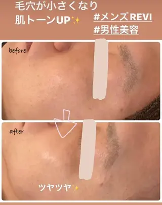 luana beauty所属・kana ハーブピーリング🌿のエステ・リラクイメージ