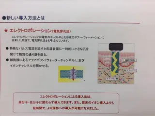 ジョリ   ヴェール 山口のマツエク・マツパデザイン