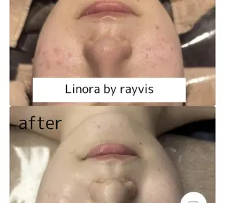 🌈Linora byRAYVIS🌈のエステ・リラクイメージ
