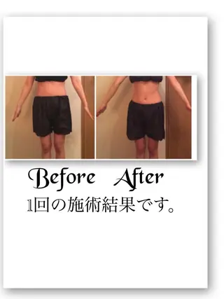 FLEUR大阪・美容 整体・痩身・小顔のエステ・リラクイメージ