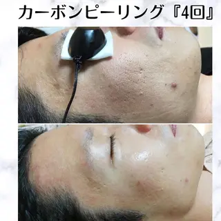 メンズ 男女同額脱毛エステ salonLEPIAのエステ・リラクイメージ