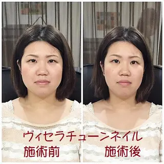 ネイル マナビス& ボワールのネイルデザイン