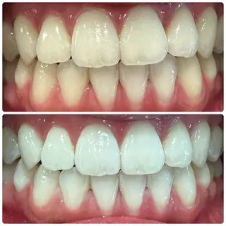 PLATINUM Beauty 横浜店所属・ホワイトニングルーム 横浜店のその他イメージ