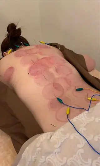 新宿hari-me所属・美容鍼hari-me 新宿のエステ・リラクイメージ