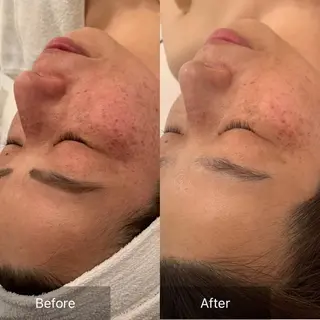 ショート カラー パーマ ヘアアレンジ メンズ キッズ ネイル マツエク・マツパ アイブロウ ハーブピーリング✨ 🌿最強痩身🔥のエステ・リラクイメージ