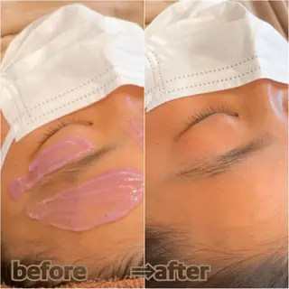 aroma  YURARI所属・韓国艶美人// 毛穴ケア🌹のエステ・リラクイメージ