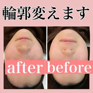 ■超絶小顔＆肌管理室■所属・🦋整形級の究極美顔 本格韓国式小顔🦋のエステ・リラクイメージ