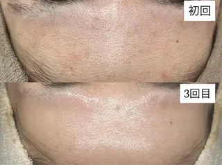 BELLIS HUIT所属・肌質改善｜体質改善ꕤ BELLISHUITのエステ・リラクイメージ