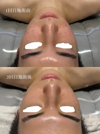 メンズ USHIN 心斎橋所属・るぎ くんのエステ・リラクイメージ