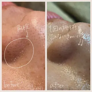 sourire.11 ‪☺︎‬‪emiのエステ・リラクイメージ