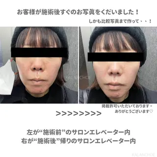 肌質改善 KALANCHOEのエステ・リラクイメージ