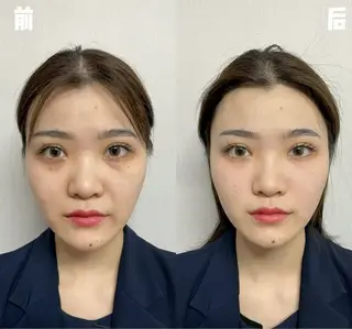 マツエク・マツパ aliaハイフ&水光ジェットサロン所属・aliaハーブ水光店 エステティシャン募集のエステ・リラクイメージ