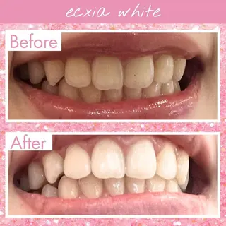 セルフホワイトニング エクシア福島のその他イメージ