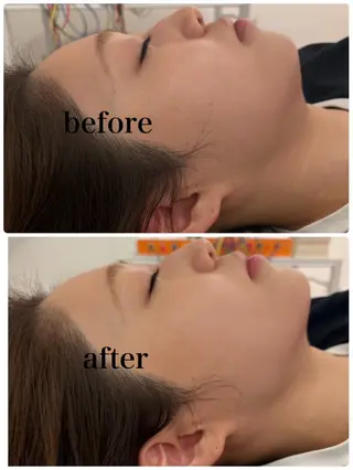 鍼灸サロン mahorobaトモのエステ・リラクイメージ