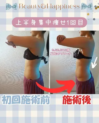 痩身ハーブピーリング 筋膜リリース☆B&Hのエステ・リラクイメージ