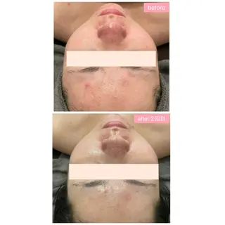 Monart -deux-のエステ・リラクイメージ