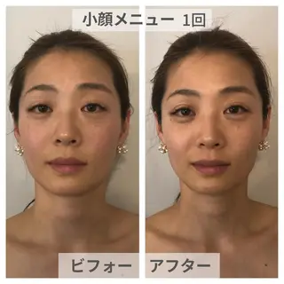 小顔・痩身専門店 Sunao所属・小顔.足痩せ整体 痩身天六Sunaoのその他イメージ
