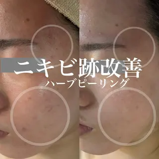 WHITE AQUA 北千住店のエステ・リラクイメージ