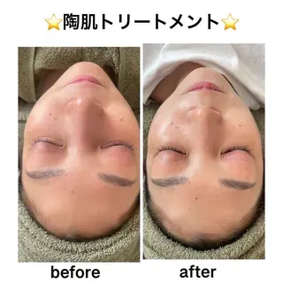 アロマ,陶肌 SalonYokoのエステ・リラクイメージ