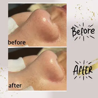 ピーリング専門店 Belluteのエステ・リラクイメージ