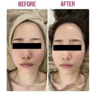 プラティーヌ ボーテ【もものり】のその他イメージ