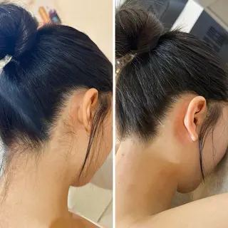 うなじ脱毛/美肌脱毛 LABELのエステ・リラクイメージ