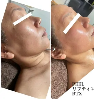 Total Beauty salon Bloom所属・トータルビューティー サロン　Bloomのエステ・リラクイメージ