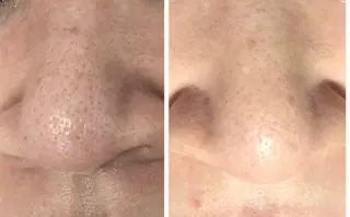 private salon Dea_maris シュガーリング&パーソナルボディケア所属・シミ改善・韓国肌管理 ボディメイク痩身のその他イメージ