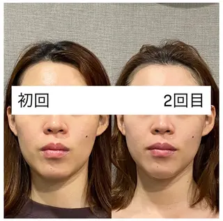 肌質改善専門 ハーブ /毛穴洗浄 リエイトのエステ・リラクイメージ