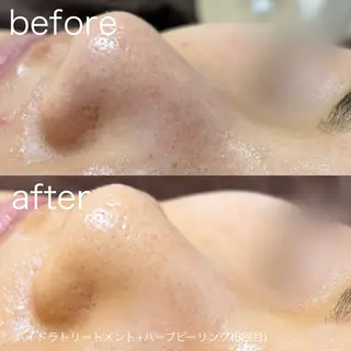 lulularico Yuのエステ・リラクイメージ