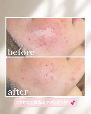 lulularico Yuのエステ・リラクイメージ