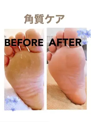 【天神・大名】脱毛/ ハーブ植松७९०のその他イメージ