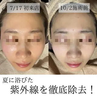 ハーブピーリング・毛穴ケア専門サロンSalon de LENA所属・ハーブピーリング 専門店/名古屋駅前店のエステ・リラクイメージ