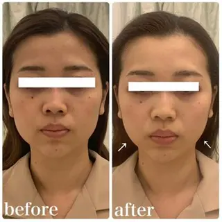 毛穴/小顔専門♡ アトリエリュバンのエステ・リラクイメージ