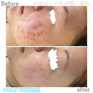 ショート カラー パーマ ヘアアレンジ メンズ キッズ ネイル マツエク・マツパ アイブロウ ニキビ&跡改善サロン オーナー光木のエステ・リラクイメージ