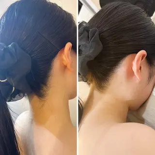 うなじ脱毛/美肌脱毛 LABELのエステ・リラクイメージ