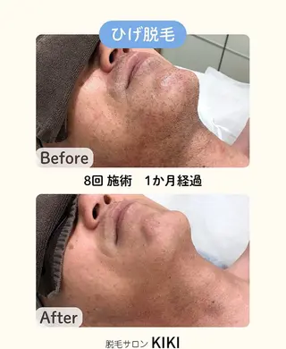 脱毛サロンKIKI所属・脱毛サロンKIKI みゆのエステ・リラクイメージ