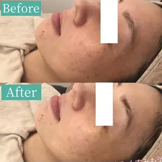 ✨美肌水光✨ アトリエリュバンのエステ・リラクイメージ