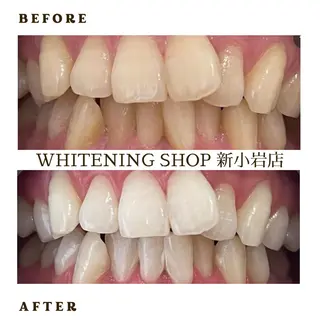 メンズ ホワイトニング ショップ新小岩店のその他イメージ