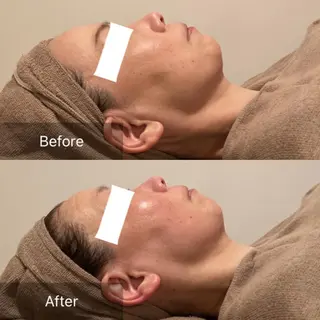 Ｂ&H所属・頭痛•肩こり専門/ 眉サロンB&H心斎橋のエステ・リラクイメージ