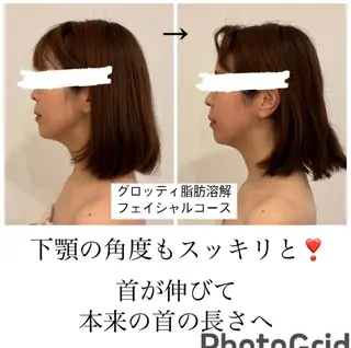 美容筋膜リリースサロンGLOW BOX所属・GLOW BOXのエステ・リラクイメージ