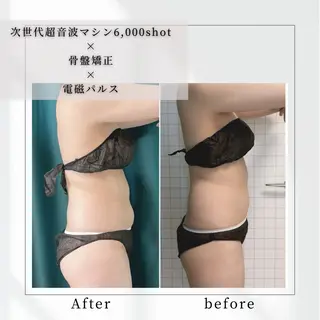 小顔矯正専門店 【RED】池田のエステ・リラクイメージ