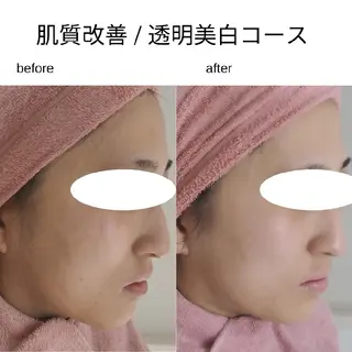 ユニセックスエステサロンUniclear所属・男女エステ ユニクリアのエステ・リラクイメージ