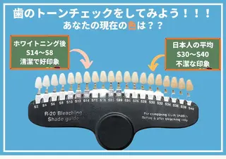 歯のホワイトニング HARU南浦和のその他イメージ
