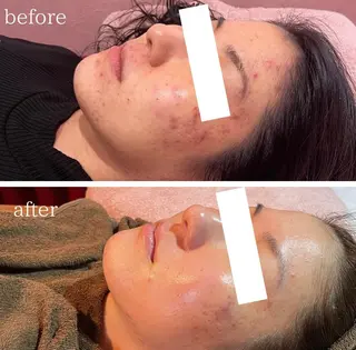 メンズ Salon aim /CHIHARUの眉毛・アイブロウイメージ