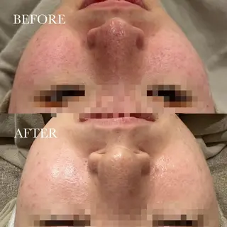 sii センター北 AIのエステ・リラクイメージ