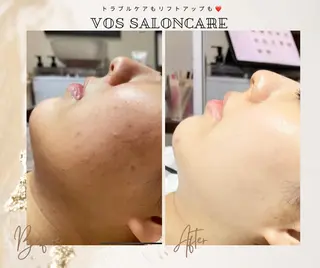 代表 MOMOの眉毛・アイブロウイメージ