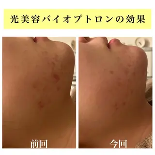 Bellesthe (ベルエステ)のエステ・リラクイメージ