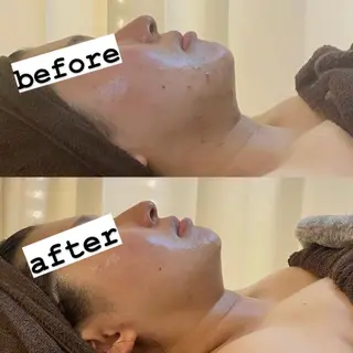 BELCIA福岡店　récolte de BELCIA（レコルトデベルシア）所属・BELCIA福岡店 レコルトデベルシアのエステ・リラクイメージ