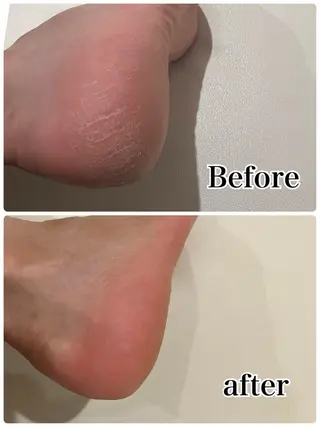 ❤︎MN❤︎ モンのエステ・リラクイメージ